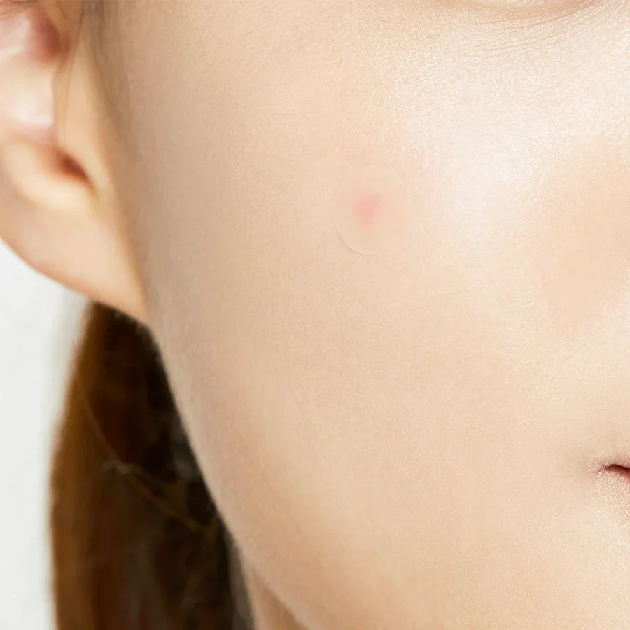 COSRX Acne Pimple Master Patch - Image 3